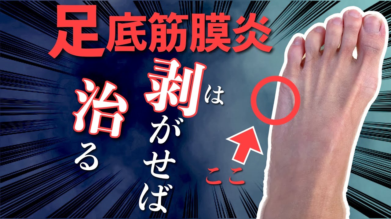 【足底筋膜炎】小指剥がしで痛み激減|足底筋膜炎専門　京都コンディショニング