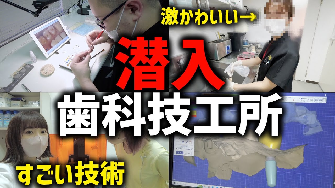 歯科技工所の世界②セラミックの作り方【自費の被せ物】