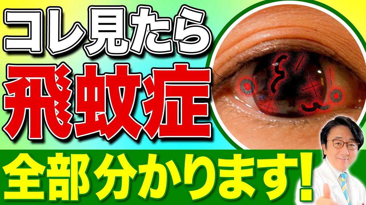 【飛蚊症傑作選】コレを見て飛蚊症について正しい知識を身につけましょう！