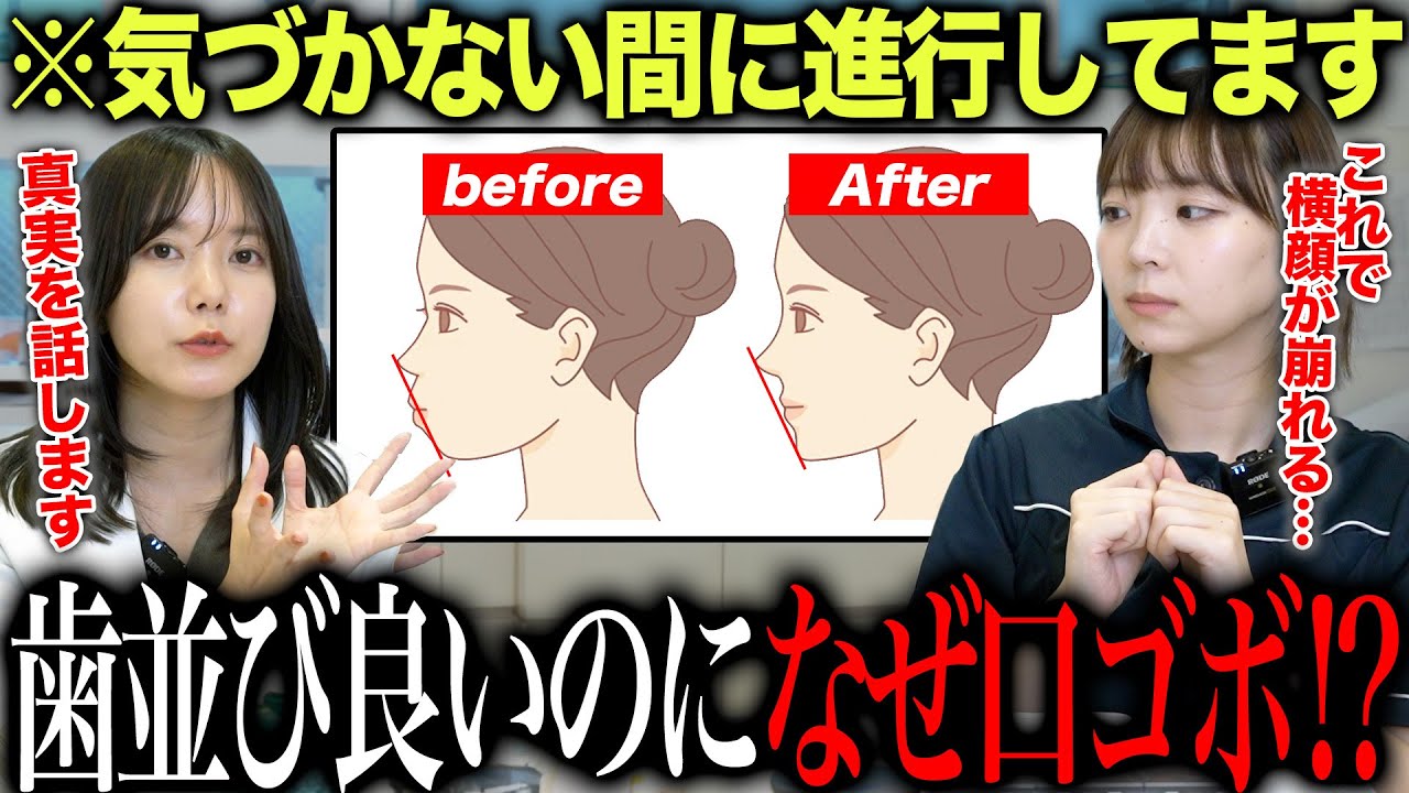 歯並びはいいのに口ゴボ!  矯正歯科医が語る原因と最新治療法の全貌