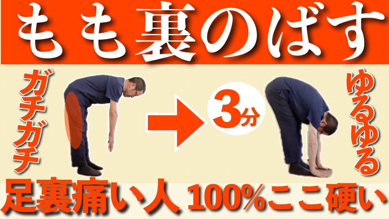 【ストレッチ絶対やめて】足裏の痛みを治す裏技