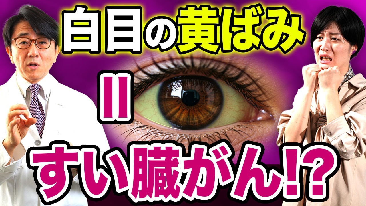 致死率の高い「すい臓がん」は目から分かる！ 眼科医が徹底解説します！