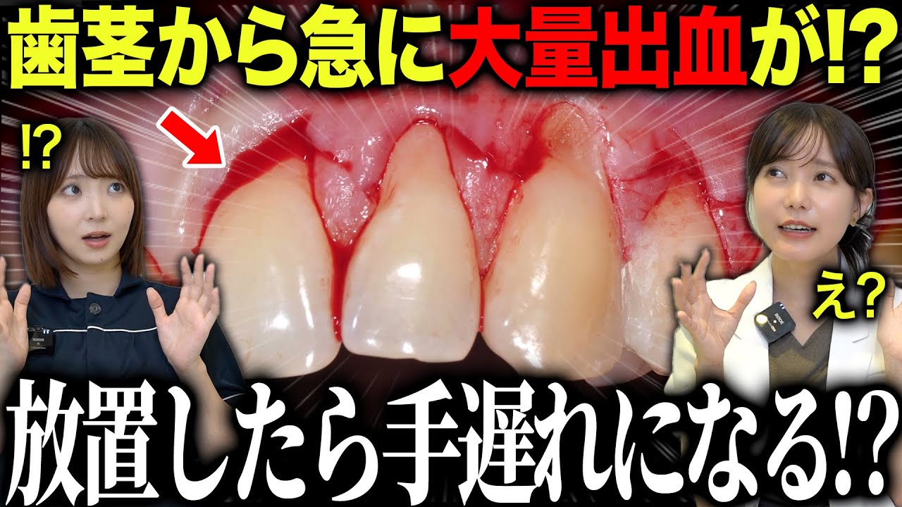 歯磨き中の出血…放置は危険。でも“出した方がいい”って知ってましたか？