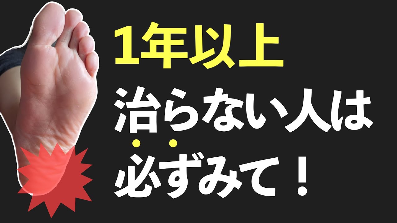 【足底筋膜炎】何をやっても治らない時の治し方