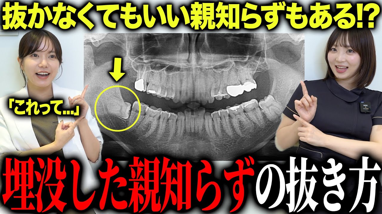 抜くのが難しい親知らずと“年齢で変わる難易度とタイムリミット”を歯科医が解説 します