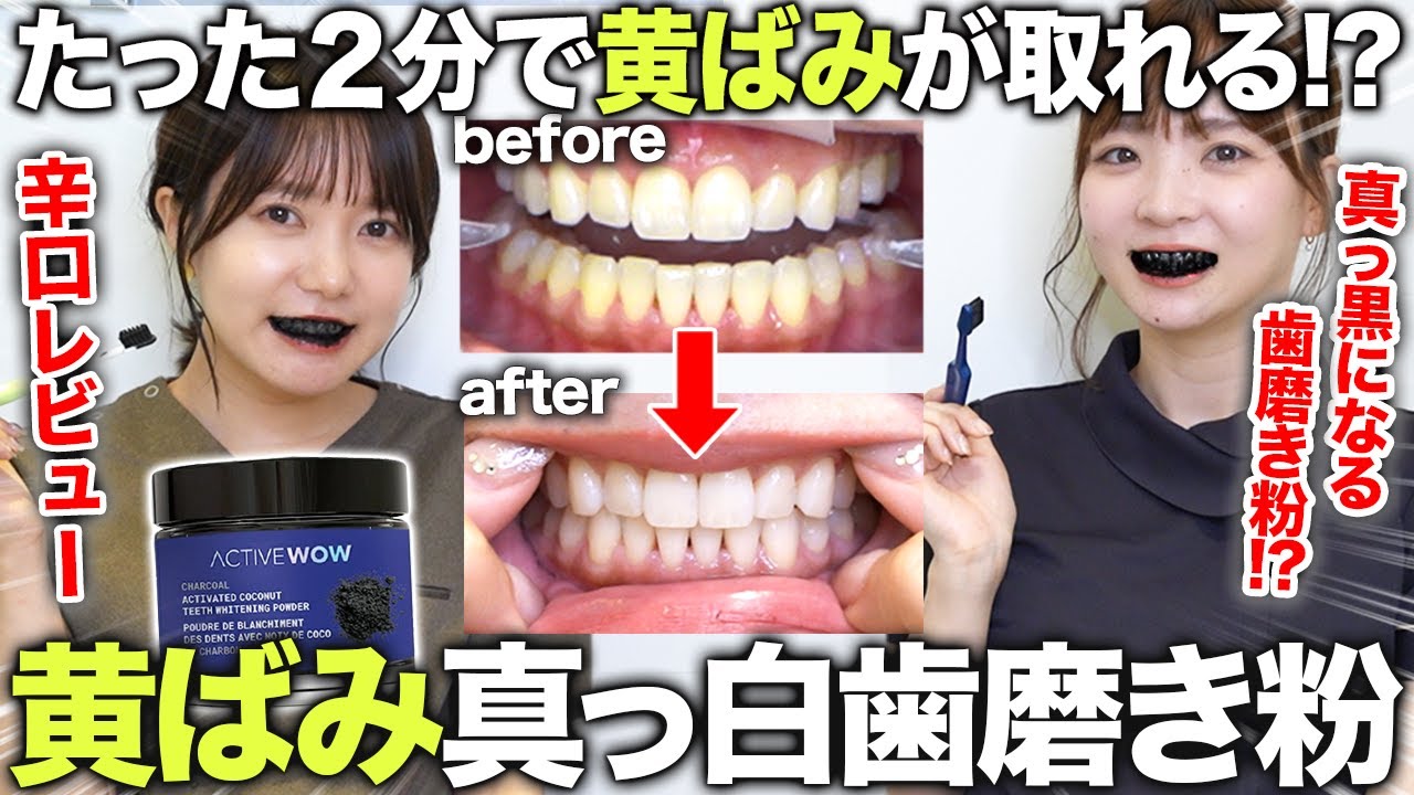 【ホワイトニング不要!?】2分で歯が白くなるという真っ黒の海外製歯磨き粉が凄すぎたw