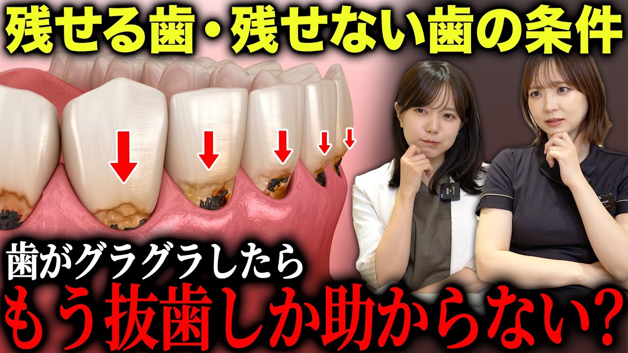 【知らないと抜歯確定？】ぐらぐらする歯が“残せる人・残せない人”の決定的な差