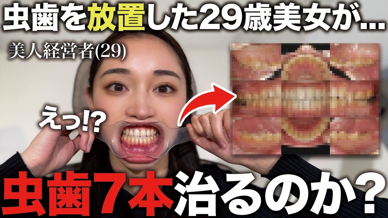 虫歯 7本の美女、歯周病発覚！？口腔内写真