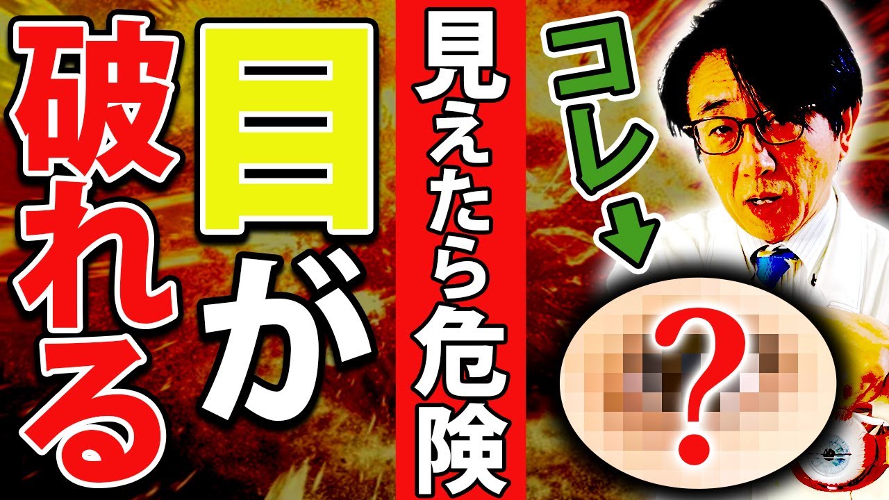 【眼科医解説】硝子体が剥がれる前触れ・症状をご紹介します！