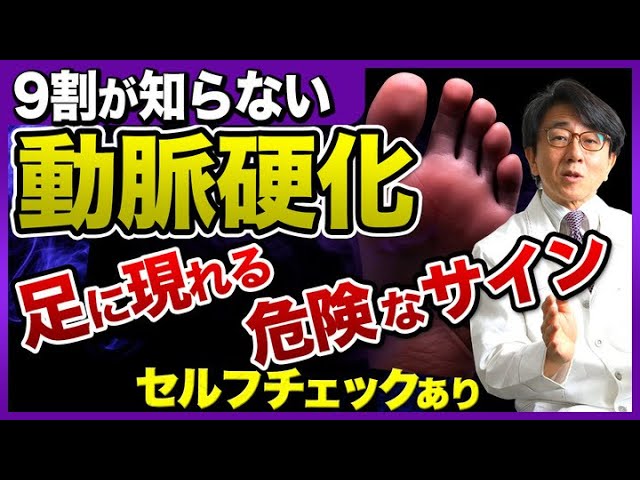 動脈硬化の症状は足にくる？危険なサインを見逃さないで！【セルフチェックあり】