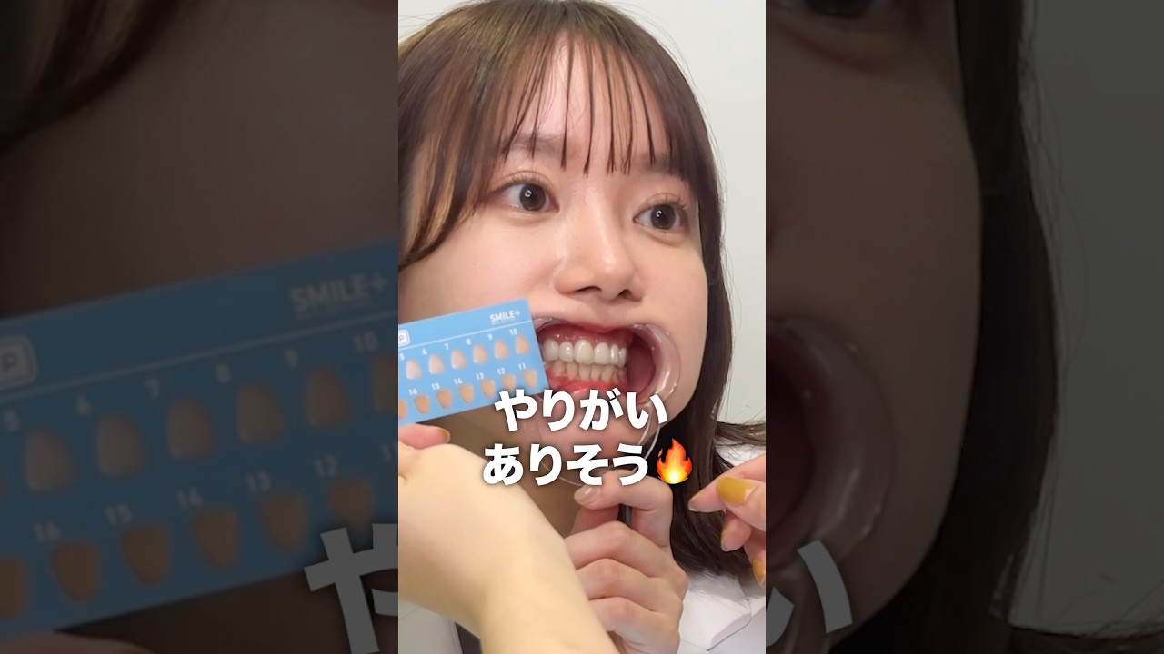 優秀すぎるとバズったホワイトニングシートを歯医者が本音レビュー！