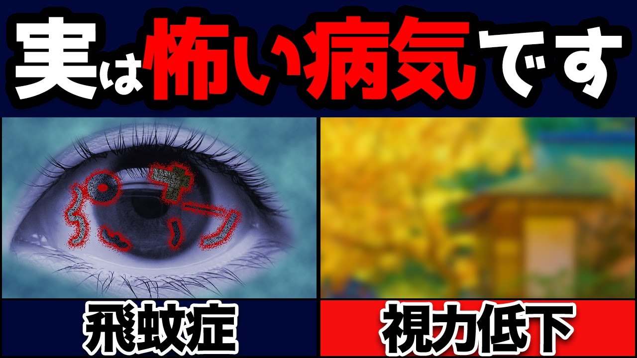 目の難病！？発見が遅れると最悪失明【眼科医解説】