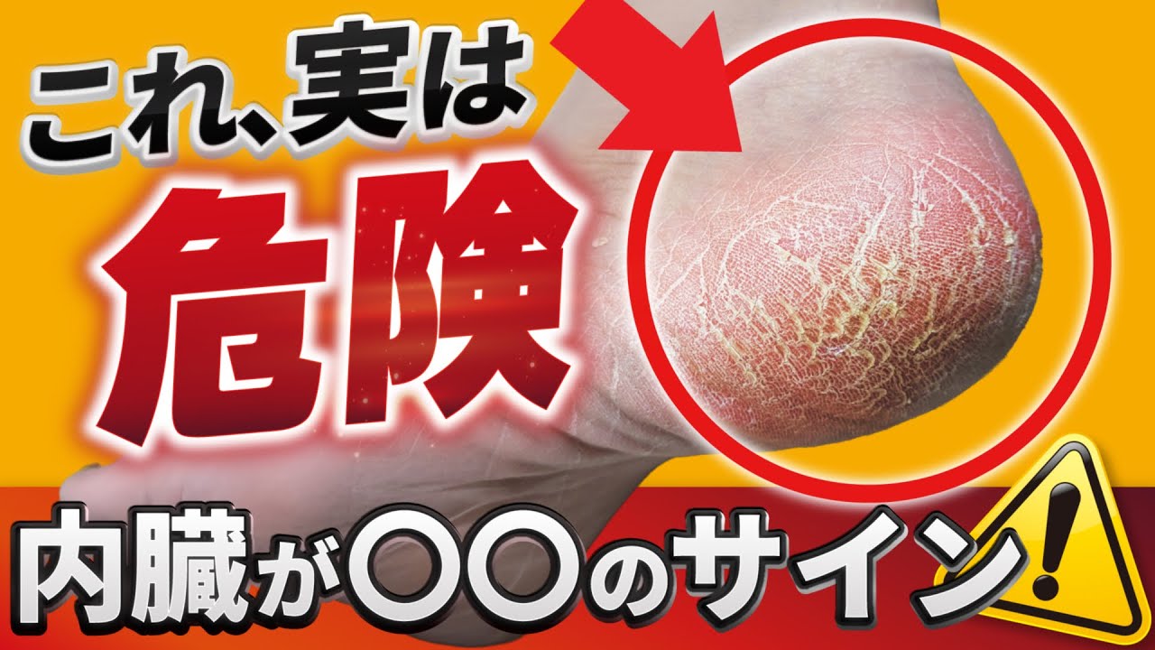 【乾燥ではなかった】踵ガサガサは内臓からのサイン