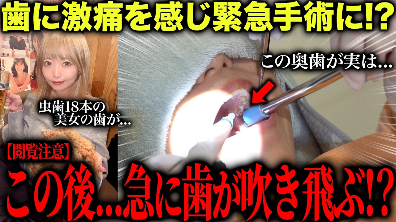 【歯科恐怖症】虫歯18本の美女が激痛を訴え...虫歯治療したらまさかの歯が取れるハプニングが！？