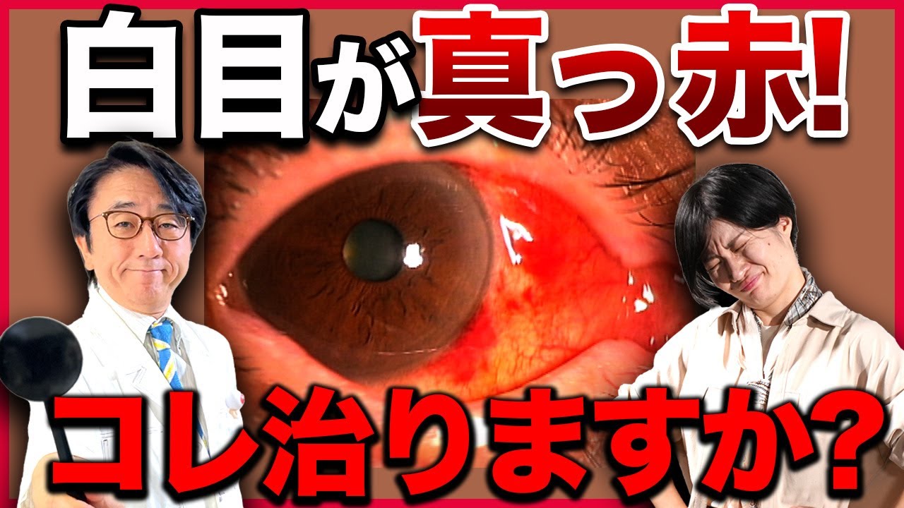 白目が真っ赤になる原因と対処法を眼科医が解説！